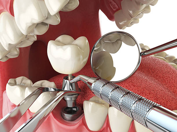 Best Cracked Tooth Emergency Dentist  in Fruit Hill, OH